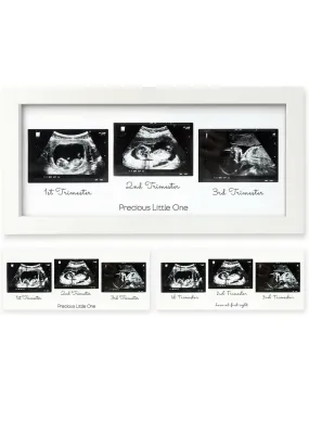 Baby Sonogram Picture Frame