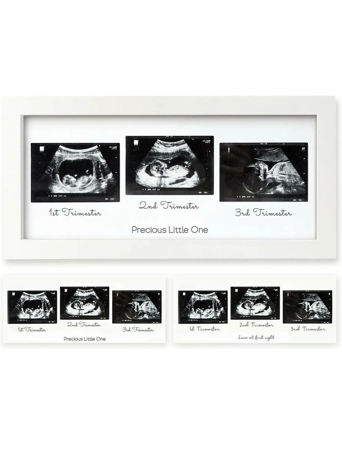 Baby Sonogram Picture Frame